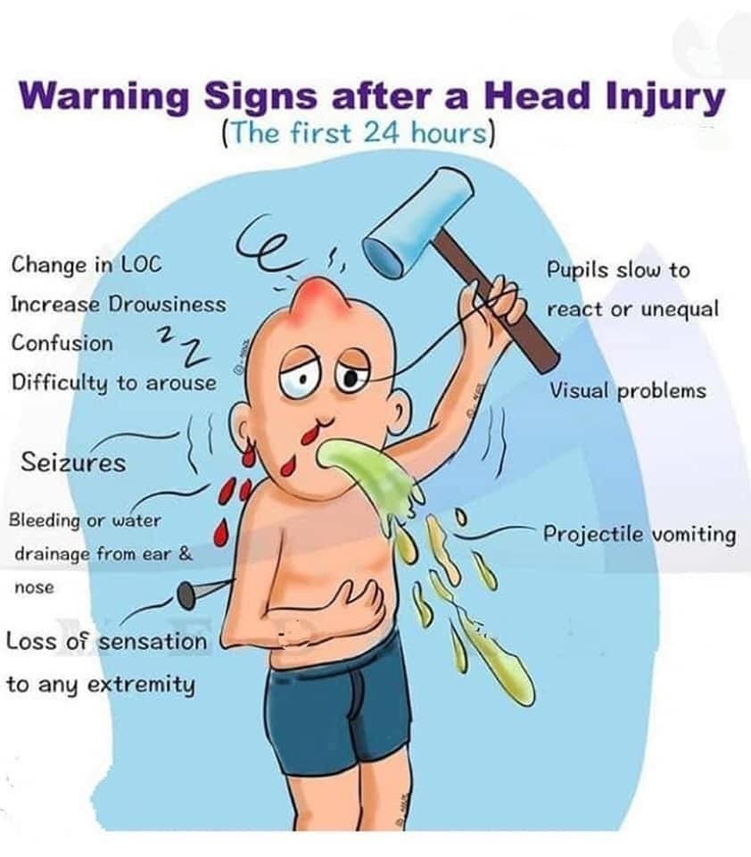Alarming signs after head injury