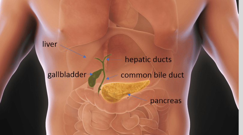 Laparoscopic Cholecystectomy