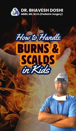 how to handle burns and scalds in kids