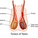 Torsion Testes