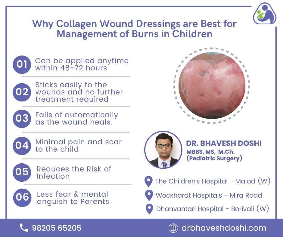 why collagen wound dressings are best for management of burns in children