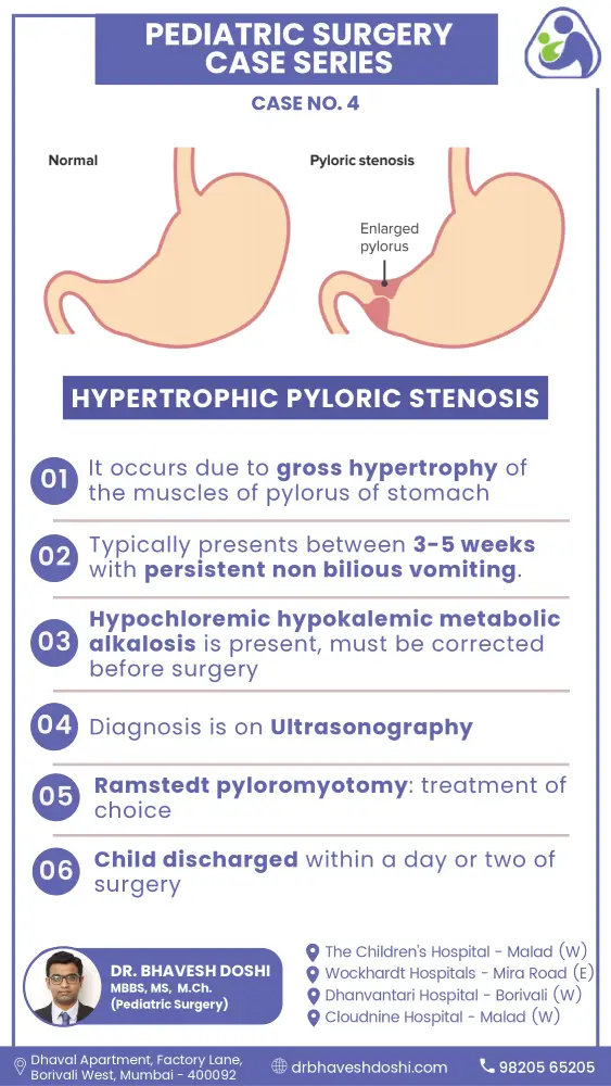 Hypertrophic Pyloric stenosis