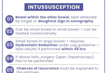 Intussusception