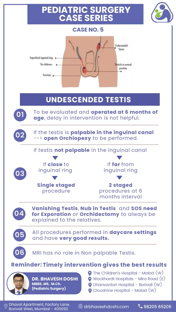 Case Undescended Testis