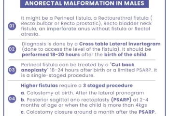Anorectal Malformation in Males