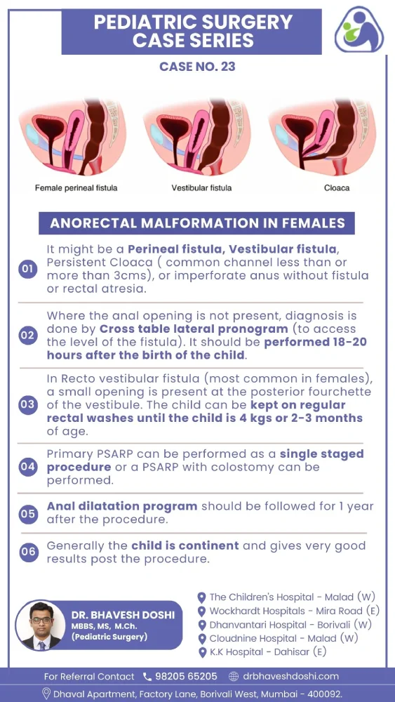 Anorectal Malformation in Females