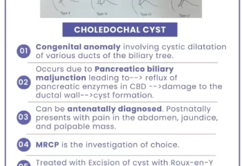 Choledochal Cyst