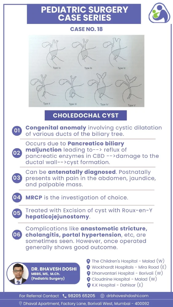 Choledochal Cyst