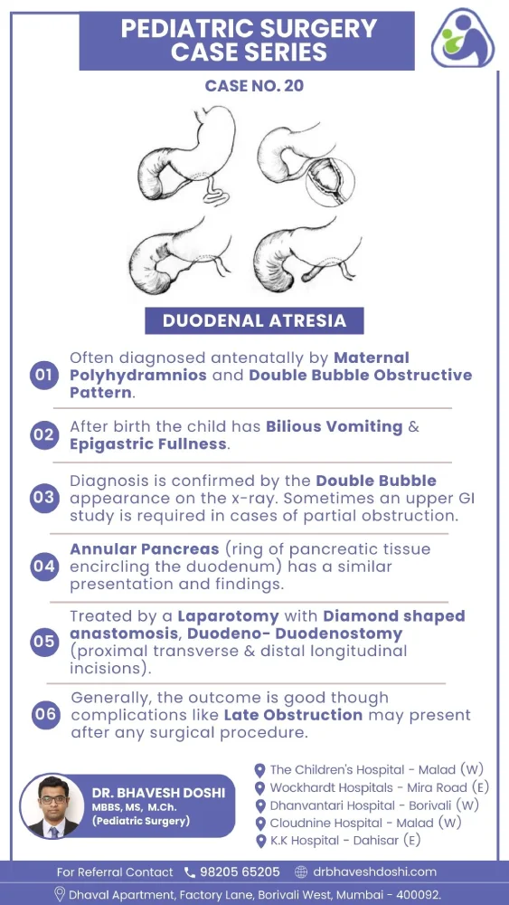 Duodenal Atresia