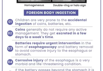 Foreign Body Ingestion