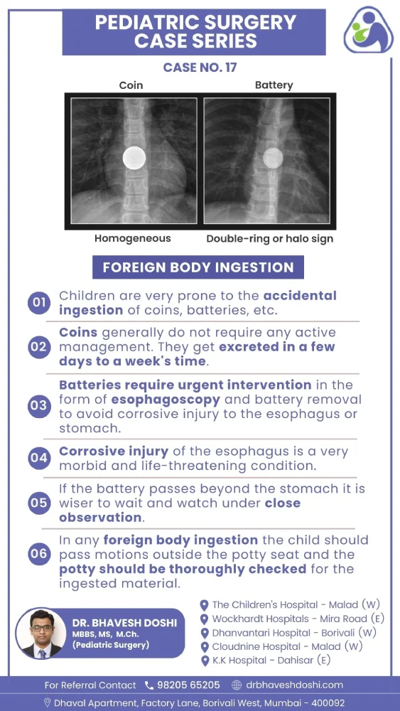 Foreign Body Ingestion