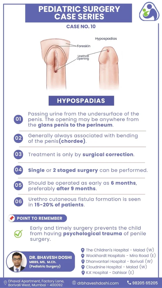 Case Hypospadias