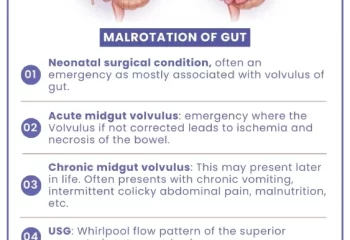 Malrotation of GUT