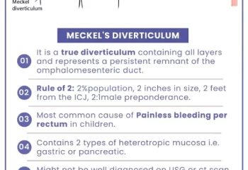 Meckel’s Diverticulum