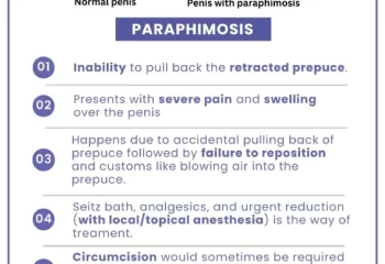 Paraphimosis
