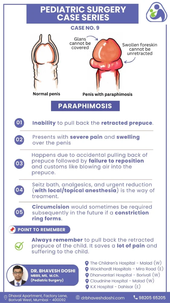 Paraphimosis