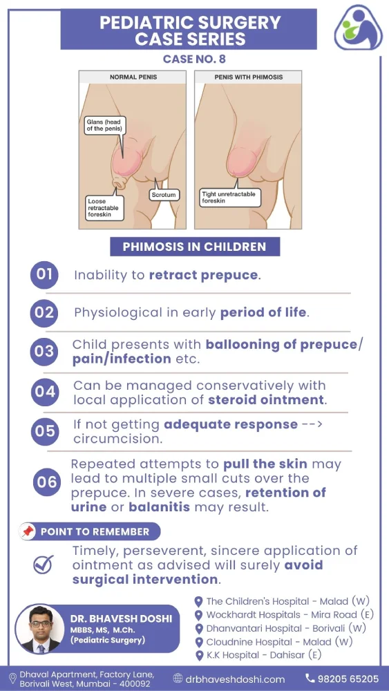 Phimosis in Children