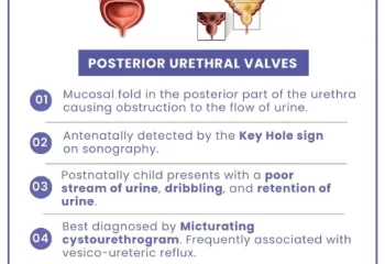 Posterior Urethral Valves