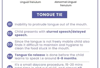 Tongue Tie