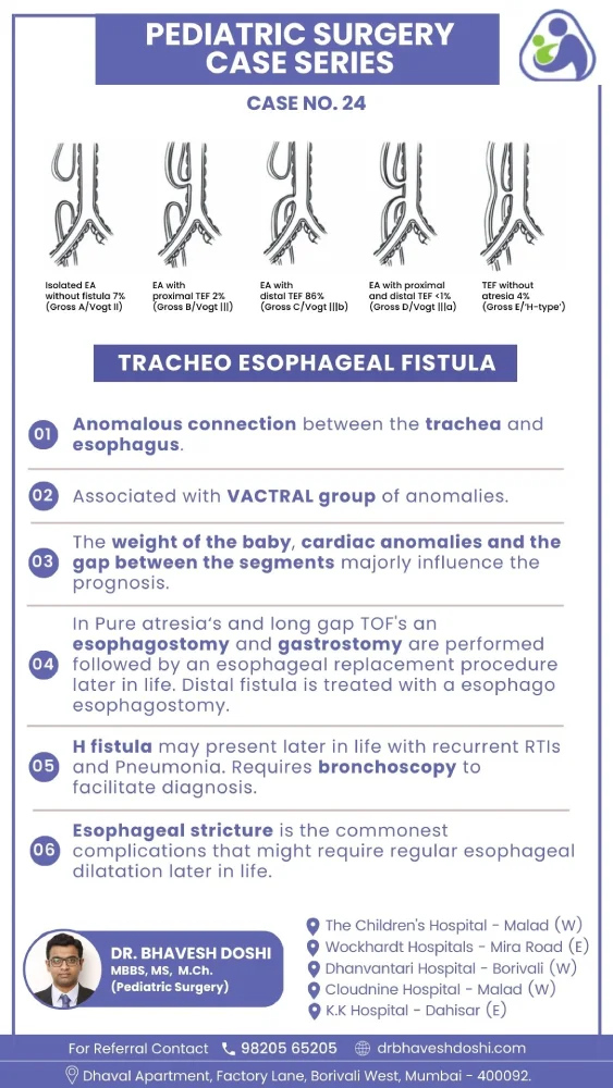 Tracheo Esophageal Fistula