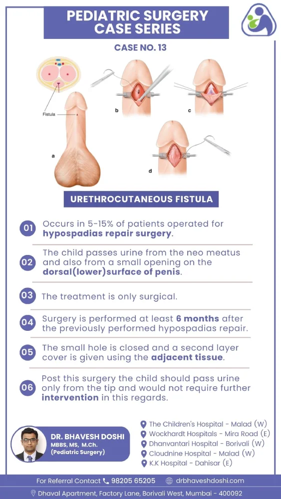 Urethrocutaneous Fistula