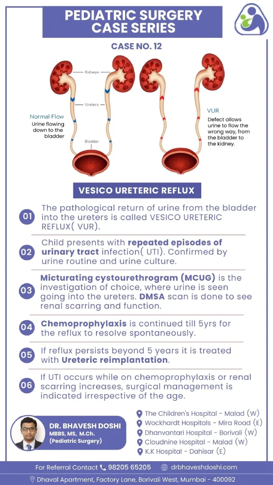 Vesico Ureteric Reflux