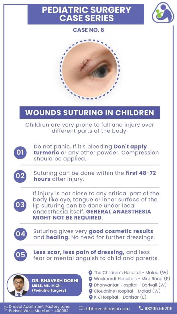 Wounds Suturing in Children