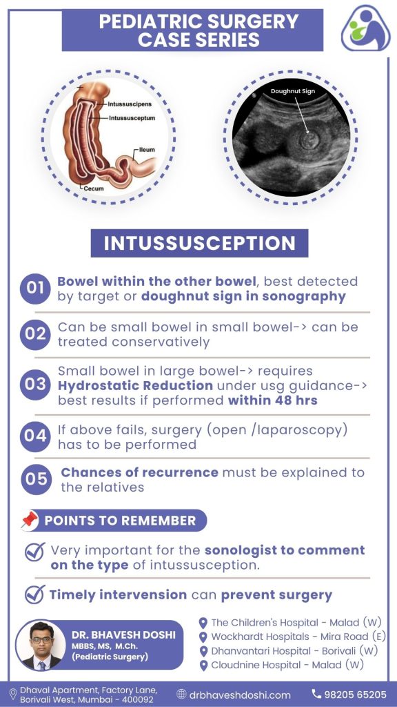 Intussusception case study