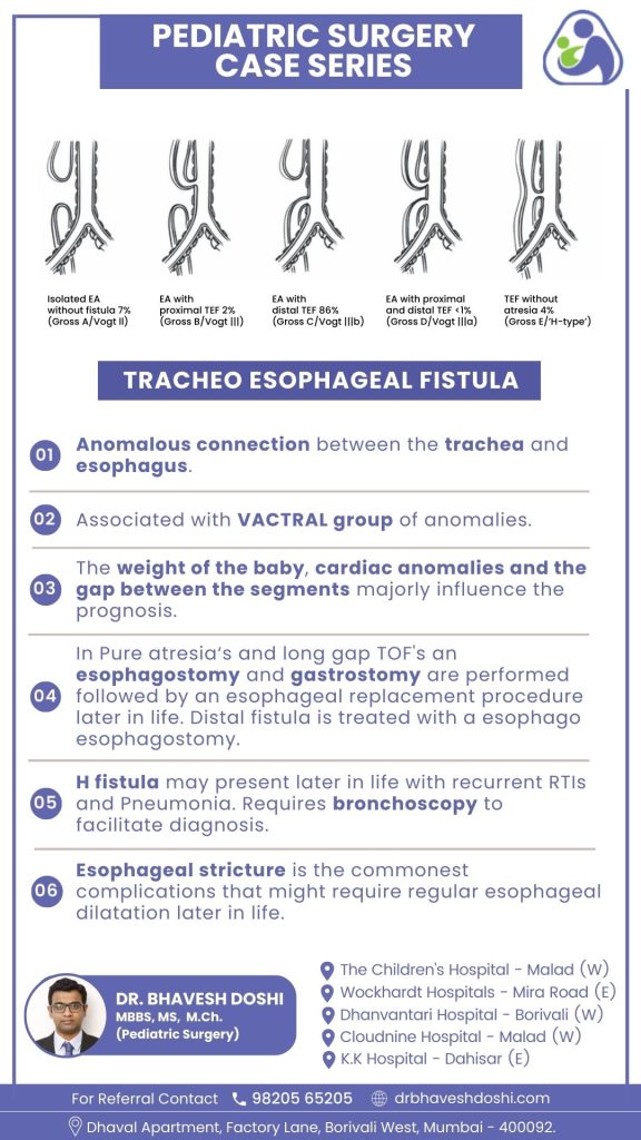 Tracheo Esophageal Fistula (TEF)