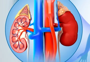 Understanding PUJ Obstruction and Pyeloplasty