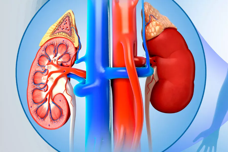 Understanding PUJ Obstruction and Pyeloplasty